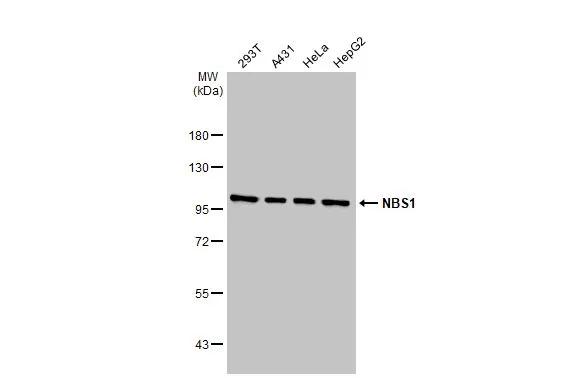 Various whole cell extracts (30 ?g) were separated by 7.5% SDS-PAGE, and the membrane was blotted with Nbs1 antibody [1D7] (NB100-221) diluted at 1:500. The HRP-conjugated anti-mouse IgG antibody was used to detect the primary antibody. 