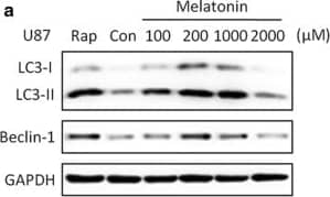 Immunocytochemistry/ Immunofluorescence: LC3B Antibody - BSA Free [NB100-2220] - The concentration-dependent effects of melatonin on the LC3-II & Beclin-1 expression in U87MG (a, b) & A172 (c, d) cells. The cells were treated with 100, 200, 1000 or 2000 μM of melatonin for 24 h. PBS was used as a negative control, & rapamycin (Rap 200 nM) served as a positive control. The levels of LC3-II & Beclin-1 expression were determined by a Western blot analysis. The protein bands for each regimen were quantified by densitometry, & their differences are presented in the graph. The values are represented as the mean ± S.E.M. for three separate determinations. Statistical significance * at P < 0.05 or ** at P < 0.01 compared with untreated controls Image collected & cropped by CiteAb from the following publication (//pubmed.ncbi.nlm.nih.gov/31870319), licensed under a CC-BY license. Not internally tested by Novus Biologicals.
