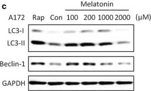 Immunocytochemistry/ Immunofluorescence: LC3B Antibody - BSA Free [NB100-2220] - The concentration-dependent effects of melatonin on the LC3-II & Beclin-1 expression in U87MG (a, b) & A172 (c, d) cells. The cells were treated with 100, 200, 1000 or 2000 μM of melatonin for 24 h. PBS was used as a negative control, & rapamycin (Rap 200 nM) served as a positive control. The levels of LC3-II & Beclin-1 expression were determined by a Western blot analysis. The protein bands for each regimen were quantified by densitometry, & their differences are presented in the graph. The values are represented as the mean ± S.E.M. for three separate determinations. Statistical significance * at P < 0.05 or ** at P < 0.01 compared with untreated controls Image collected & cropped by CiteAb from the following publication (//pubmed.ncbi.nlm.nih.gov/31870319), licensed under a CC-BY license. Not internally tested by Novus Biologicals.