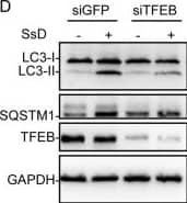 Western Blot: LC3B Antibody - BSA Free [NB100-2220] - SsD treatment of HeLa cells increases lysosomal pH & induces TFEB nuclear translocation. a, b SsD (15 μM) led to an increase of lysosomal pH in HeLa cells as measured using Lysosensor DND-189 (a) or the quantitative ratiometric LysoSensor Yellow/Blue DND-160 (b). The graphs in (b) & (c) represent data from three independent experiments, & data are expressed as the means ± S.D., n = 3. The asterisk (*) symbols indicates p < 0.05 by t-test analysis. c HeLa cells were transfected with TFEB-GFP & treated with or without SsD (15 μM) or underwent starvation before confocal imaging. d HeLa cells were transfected with siGFP or siTFEB & treated with or without SsD (15 μM), & then LC3, p62, TFEB, or GAPDH immunoblot analyses were performed Image collected & cropped by CiteAb from the following publication (//pubmed.ncbi.nlm.nih.gov/30820356), licensed under a CC-BY license. Not internally tested by Novus Biologicals.