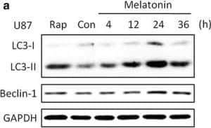 Immunocytochemistry/ Immunofluorescence: LC3B Antibody - BSA Free [NB100-2220] - The time-dependent effects of melatonin on the LC3-II & Beclin 1 expression in U87MG (a, b) & A172 (c, d) cells. The cells were treated with 1 mM melatonin for 4, 12, 24 or 36 h. PBS was used as a negative control, & rapamycin (Rap 200 nM) served as a positive control. The levels of LC3-II & Beclin-1 expression were determined by a Western blot analysis. The protein bands for each regimen were quantified by densitometry, & their differences are presented in the graph. The values represent the mean ± S.E.M. for three separate determinations. Statistical significance * at P < 0.05 or ** at P < 0.01 compared with untreated controls Image collected & cropped by CiteAb from the following publication (//pubmed.ncbi.nlm.nih.gov/31870319), licensed under a CC-BY license. Not internally tested by Novus Biologicals.