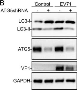 Western Blot: LC3B Antibody - BSA Free [NB100-2220] - Autophagy is involved in EV-A71 replication in HeLa cells. a VP1 synthesis was dramatically reduced by BAF (50 or 10 nM) treatment in EV71-infected cells compared to cells without BAF treatment. b ATG5 knockdown markedly inhibited EV-A71 infection in HeLa cells. c SsD treatment failed to further inhibit AV-A71 infection in ATG5-knockdown HeLa cells. d Rapamycin treatment enhanced EV-A71 infection in HeLa cells. e SsD treatment markedly inhibited EV-A71 infection in HeLa cells treated with or without Torin-1 Image collected & cropped by CiteAb from the following publication (//pubmed.ncbi.nlm.nih.gov/30820356), licensed under a CC-BY license. Not internally tested by Novus Biologicals.