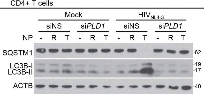 Western Blot: LC3B Antibody - BSA Free [NB100-2220] - PLD1 silencing prevents TNP-induced autophagy & decreases in HIV p24 release. Mock- & HIV-infected macrophages (A to C) & CD4+ T cells (D to F) transfected with PLD1 siRNA (siPLD1) or scrambled siRNA (siNS) were exposed to vehicle, 400 μg ml−1 RBC-NP (R), or 400 μg ml−1 TNP (T) for 4 h, washed three times with PBS, & then incubated for a further 24 h. n = 4. (A & D) (Bottom) Representative western blots of PLD1. (Top) Densitometric analysis of blots. (B & E) (Top) Representative western blots of LC3B isoforms & SQSTM1. (Bottom) Densitometric analysis of blots. (C & F) Enzyme-linked immunosorbent assays were performed for HIV p24 antigen in the supernatant. Image collected & cropped by CiteAb from the following publication (//pubmed.ncbi.nlm.nih.gov/32934078), licensed under a CC-BY license. Not internally tested by Novus Biologicals.