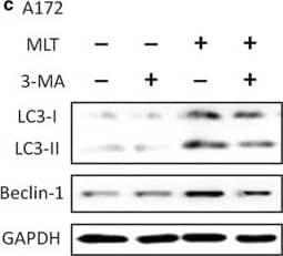 Immunocytochemistry/ Immunofluorescence: LC3B Antibody - BSA Free [NB100-2220] - Melatonin-induced autophagy was abolished by treatment with an autophagy inhibitor, 3-MA. The results of the Western blotting of LC3 & Beclin-1 in the U87MG (a, b) & A172 (c, d) cells treated with PBS (control) or melatonin (MLT 1 mM) for 24 h in the presence & absence of 3-MA (10 mM). Statistical significance * at P < 0.05 compared with untreated controls or the corresponding group Image collected & cropped by CiteAb from the following publication (//pubmed.ncbi.nlm.nih.gov/31870319), licensed under a CC-BY license. Not internally tested by Novus Biologicals.