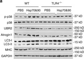 Western Blot: LC3B Antibody - BSA Free [NB100-2220] - TLR4 is critical to Hsp70/Hsp90-induced muscle wasting in mice. a Hsp70 & Hsp90-induced muscle catabolism in mice is dependent on TLR4. Wild-type & TLR4 null mice were injected with rHsp70 & rHsp90 & analyzed for catabolic response in TA as described in Fig. 4. b Hsp70 & Hsp90-induced muscle wasting is TLR4-dependent. Wild-type & TLR4 null mice injected with rHsp70 & rHsp90 are further analyzed for muscle wasting. Scale bar, 100 μm. Data (n = 5) were analyzed by analysis of variance or χ2 analysis (for CSA). * denotes a difference (P < 0.05) Image collected & cropped by CiteAb from the following publication (//www.nature.com/articles/s41467-017-00726-x), licensed under a CC-BY license. Not internally tested by Novus Biologicals.
