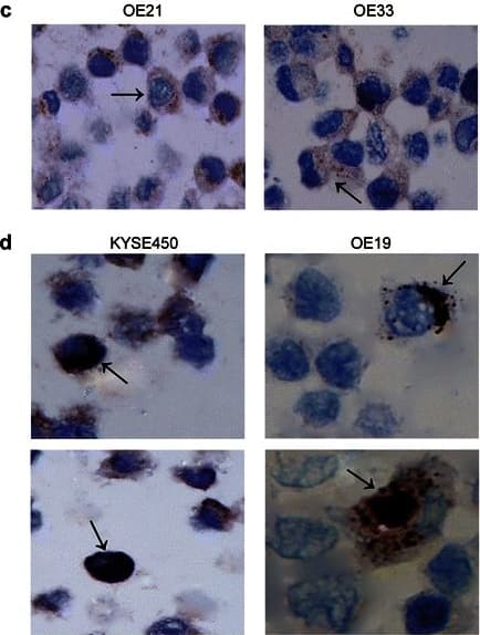 Immunohistochemistry-Paraffin: LC3B Antibody - BSA Free [NB100-2220] - Western blot analysis of human recombinant microtubule-associated proteins 1A/1B light chain 3A & 3B probed with either a the Abgent anti-LC3 antibody (AP1802a), or b MBL anti-LC3A/B antibody. LC3 bands were quantified using the Odyssey Infrared Imaging System (Li-Cor), & data presented as integrated intensities (n = 3). c Analysis of LC3B distribution in untreated OE21 & OE33 esophageal cancer cell lines. Arrows indicate diffuse cytoplasmic LC3B expression (magnification 400×) (n = 6). d Analysis of LC3B distribution in untreated KYSE450 & OE19 esophageal cell lines. Arrows indicate the presence of LC3B crescent or ring-like (upper panels) & globular (lower panels) structures in KYSE450 & OE19 cells (magnification 1000×) (n = 6) Image collected & cropped by CiteAb from the following publication (//pubmed.ncbi.nlm.nih.gov/26265176), licensed under a CC-BY license. Not internally tested by Novus Biologicals.