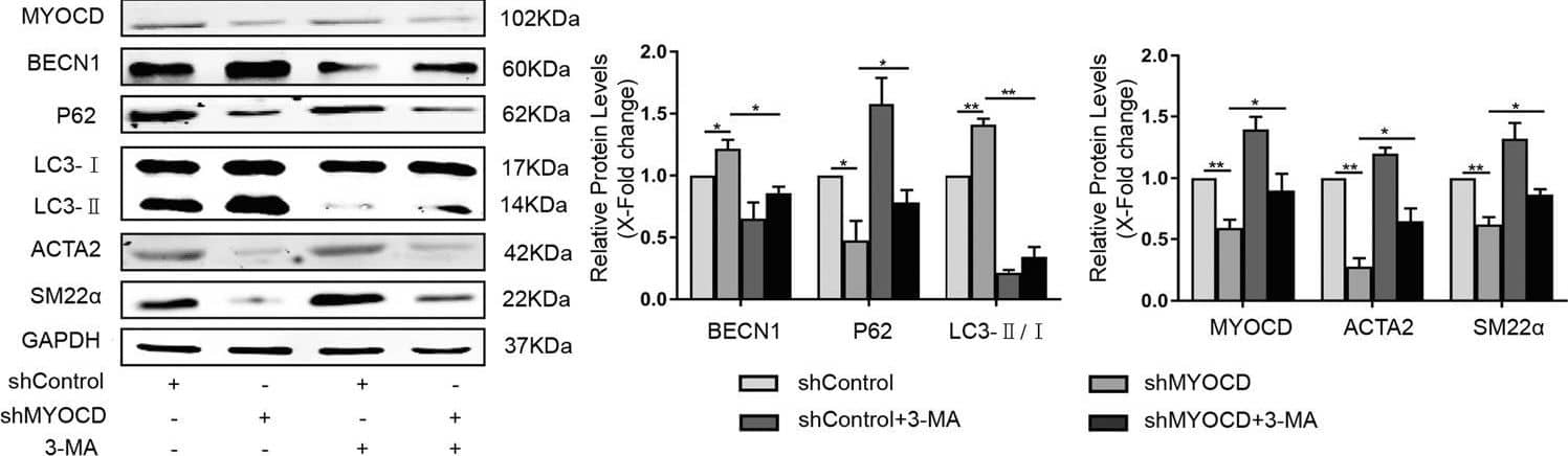 Western Blot: LC3B Antibody - BSA Free [NB100-2220] - Inhibition of autophagy in MYOCD-knockdown cells restored the expression of contractile proteins.HA-VSMCs were transfected with shMYOCD plasmid for 4 h & then treated with 5 mM 3-MA for another 48 h. Western blot images & quantification in each group were shown (*P < 0.05, **P < 0.01, n = 3). Image collected & cropped by CiteAb from the following publication (//pubmed.ncbi.nlm.nih.gov/35136037), licensed under a CC-BY license. Not internally tested by Novus Biologicals.