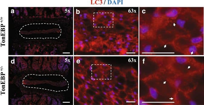 Immunocytochemistry/ Immunofluorescence: LC3B Antibody - BSA Free [NB100-2220] - TonEBP haploinsufficient mice do not show altered autophagy in NP. LC3 immunofluorescence staining of intervertebral discs from 4-month-old TonEBP+/+ (a–c) & haploinsufficient TonEBP+/− (d–f) mice demonstrated similar pattern & distribution of LC3 positive autophagosomes. (a,d) White dotted line demarks the NP tissue compartment. (c,f) Magnified images of dotted inserts from B & E respectively. White arrows indicate LC3-positive autophagosomes. Scale bar: 200 μm for (a) & (d); 20 μm for (b), (c), (e), & (f). Image collected & cropped by CiteAb from the following publication (//pubmed.ncbi.nlm.nih.gov/28674405), licensed under a CC-BY license. Not internally tested by Novus Biologicals.