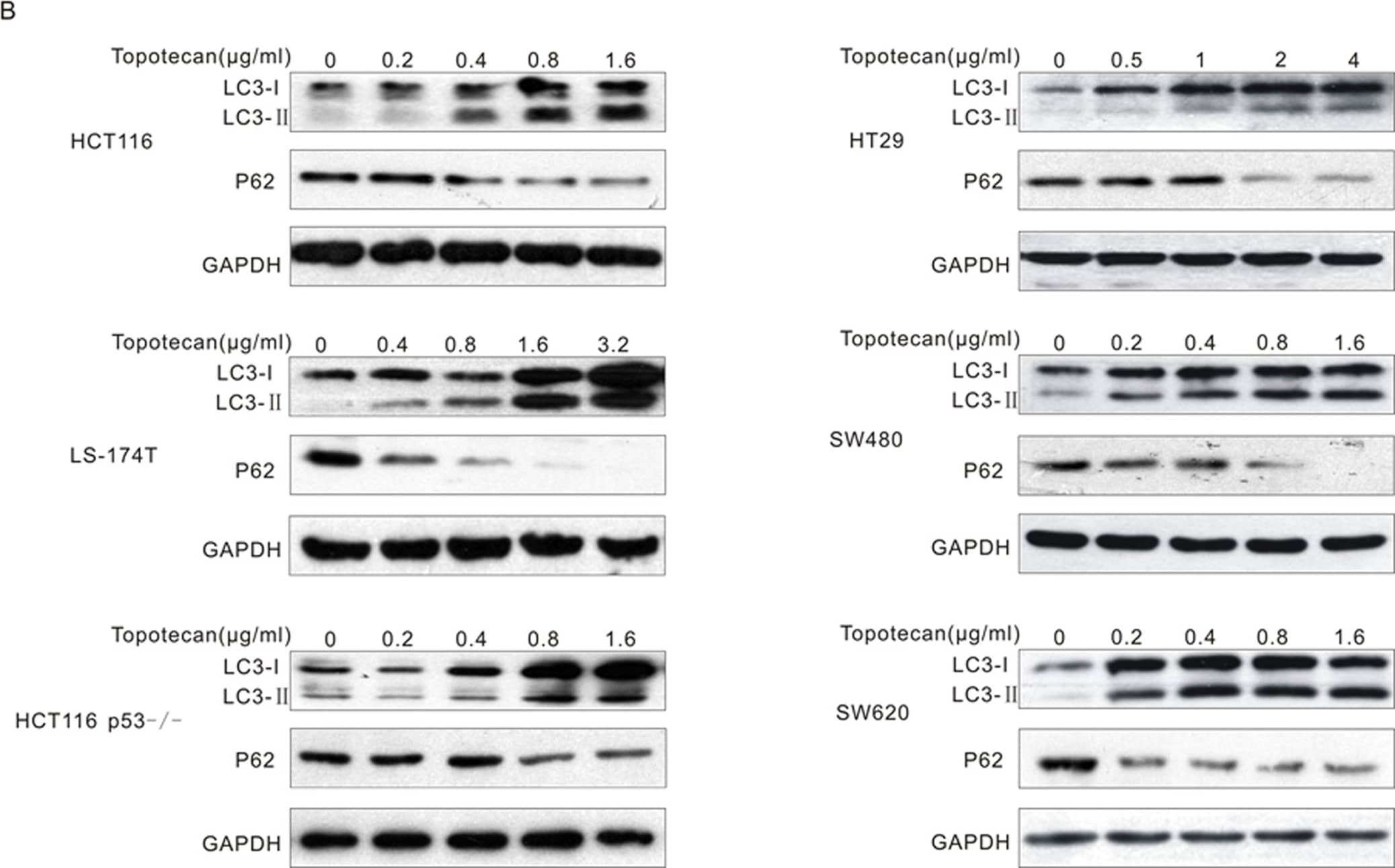 Western Blot: LC3B Antibody - BSA Free [NB100-2220] - Topotecan treatment triggers autophagy in colon cancer cells.A. HCT116, LS-174T & HT29 cells were transfected for 24 h with an expression construct encoding LC3 fused to the yellow fluorescent protein (YFP-LC3). Thereafter, the cells were treated with or without 1 µg/mL topotecan (TPT) for 24 h & visualised under a confocal microscope. B. The indicated cells were treated with the indicated concentrations of topotecan for 24 h. The lysates were analysed by immunoblotting with The LC3 & P62 antibodies. Image collected & cropped by CiteAb from the following publication (//pubmed.ncbi.nlm.nih.gov/23024792), licensed under a CC-BY license. Not internally tested by Novus Biologicals.