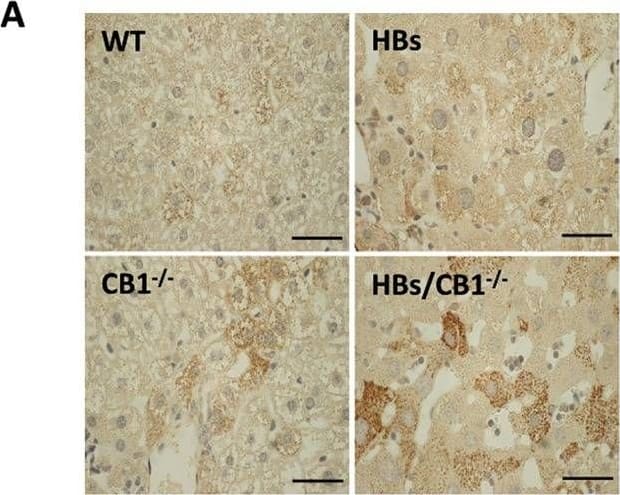 Immunohistochemistry: LC3B Antibody - BSA Free [NB100-2220] - CB1 knockout elevated autophagy in the liver of HBs transgenic mice. a Representative immunohistochemical analysis of paraffin-embedded liver sections from 52-week-old mice was performed using anti-LC3B antibody. Original image magnification ×1000, bar 40 µm. b Quantification of LC3B puncta assessed with ImageJ software & expressed as % of LC3B staining/field. c Western blot analysis of lysates from 52-week-old mice was performed using specific anti-LC3B & anti-p62 antibodies. d Representative immunofluorescence analysis of paraffin-embedded liver sections of 52-week-old mice was performed using specific anti-LAMP1 antibodies (red). Nuclei were stained with DAPI (blue). Magnification ×1000, bar 40 µm Image collected & cropped by CiteAb from the following publication (//pubmed.ncbi.nlm.nih.gov/31570772), licensed under a CC-BY license. Not internally tested by Novus Biologicals.