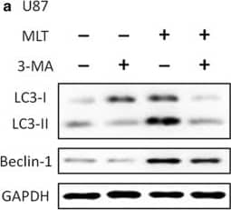 Immunocytochemistry/ Immunofluorescence: LC3B Antibody - BSA Free [NB100-2220] - Melatonin-induced autophagy was abolished by treatment with an autophagy inhibitor, 3-MA. The results of the Western blotting of LC3 & Beclin-1 in the U87MG (a, b) & A172 (c, d) cells treated with PBS (control) or melatonin (MLT 1 mM) for 24 h in the presence & absence of 3-MA (10 mM). Statistical significance * at P < 0.05 compared with untreated controls or the corresponding group Image collected & cropped by CiteAb from the following publication (//pubmed.ncbi.nlm.nih.gov/31870319), licensed under a CC-BY license. Not internally tested by Novus Biologicals.