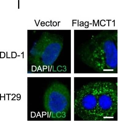Immunohistochemistry: LC3B Antibody - BSA Free [NB100-2220] - OSI induces autophagy through upregulation of MCT1 in CRC cells.a Immunoblotting analysis of MCT1 expression in CRC cells treated with or without 5 μM OSI for 24 h. b Immunoblotting analysis of MCT1 & phosphorylated AMPK in tumor xenografts obtained from vehicle- or OSI-treated mice. (Each protein of interest from each group was electrophoretically transferred onto a PVDF membrane, incubated with indicated primary & secondary antibodies, & developed as a digital image.) c Immunohistochemical analysis of MCT1 expression in tumor xenografts. Scale bar, 50 μm. d Relative intensity of MCT1 staining in (c). e CRC cells were transfected with siScramble or siMCT1 for 24 h, followed by treatment with or without 5 μM OSI for another 24 h. The protein levels of LC3, phosphorylated AMPK, phosphorylated LKB1 & MCT1 were analyzed by immunoblotting. f CRC cells were treated as in (e), the endogenous LC3 puncta were analyzed by immunofluorescence. Scale bar, 10 μm. g The number of LC3 puncta in (f). h CRC cells were transfected with empty vector or Flag-MCT1 plasmid for 48 h, the protein levels of MCT1 & phosphorylated AMPK were analyzed by immunoblotting. i CRC cells were treated as in (h), the endogenous LC3 puncta were analyzed by immunofluorescence. Scale bar, 10 μm. j The number of LC3 puncta in (i). k Immunoblotting analysis of LC3, MCT1 & phosphorylated AMPK levels in CRC cells co-transfected with Flag-MCT1 & DN-AMPK plasmids for 48 h. l CRC cells were treated as in (k), the endogenous LC3 puncta were analyzed by immunofluorescence. Scale bar, 10 μm. m The number of LC3 puncta per cell in (l). Data are presented as mean SEM, Student’s t-test, & are representative of three independent experiments. *P < 0.05; ***P < 0.001 Image collected & cropped by CiteAb from the following publication (//pubmed.ncbi.nlm.nih.gov/31409796), licensed under a CC-BY license. Not internally tested by Novus Biologicals.