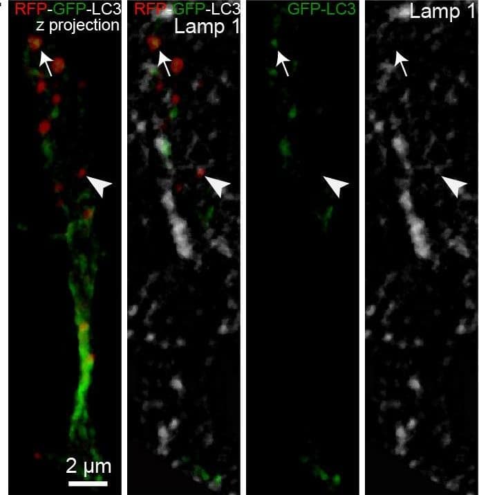 Immunocytochemistry/ Immunofluorescence: LC3B Antibody - BSA Free [NB100-2220] - Autophagy is dynamically regulated by migration-promoting & migration-inhibiting cues & is required for the recycling of paxillin.(A–C:) Immunoblotting for the lipidated form of LC3 (LC3-II), p62, & paxillin on RMS samples dissected from acute sections previously incubated with BDNF, GABA, GM60001, Y27632, or blebbistatin for 2 hr. GAPDH was used as a housekeeping protein. (D–E:) Quantification of LC3-II & paxillin levels after the pharmacological manipulation of cell migration (n = 5–7 mice for both groups, *p<0.05 & **p<0.005 with a Student t-test). (F): Example of a cell infected with a retrovirus expressing the LC3-GFP-RFP fusion protein & immunostained for Lamp1 to label autophagosomes (GFP+/RFP+) & autolysosomes (RFP+/Lamp1+). (G:) Percentage of autophagosomes & autolysosomes after a 2 hr incubation with BDNF, GABA, GM60001, Y27632, or blebbistatin. The autophagosome/autolysosome ratio was assessed for each cell, & the results are expressed as means ± SEM. ***p<0.001 with a one-way ANOVA followed by a post hoc LSD-Fisher test. Image collected & cropped by CiteAb from the following publication (//pubmed.ncbi.nlm.nih.gov/32985978), licensed under a CC-BY license. Not internally tested by Novus Biologicals.