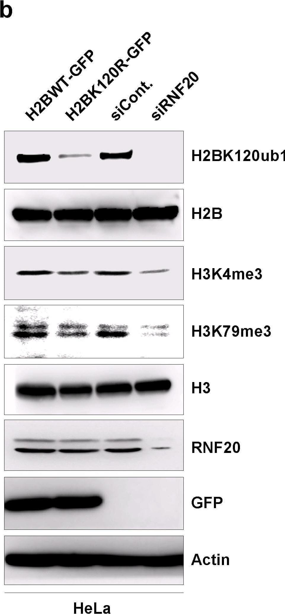Overexpression of H2BK120R efficiently reduced H2B monoubiquitination levels.a. HEK293T cells transfected with an RNF20-specific siRNA or a control siRNA and with a GFP-tagged H2BK120R mutant plasmid or an empty GFP plasmid were harvested after 48 h of transfection. Cell extracts were prepared and analyzed by western blot with the specified antibodies. b. HeLa cells were transfected with an RNF20-specific siRNA or a control siRNA and with a GFP-tagged H2BK120R mutant plasmid or an empty GFP plasmid. Cells were harvested after 48 h of transfection, and cell extracts were prepared. Western blot analysis was performed with the specified antibodies. Image collected and cropped by CiteAb from the following open publication (//pubmed.ncbi.nlm.nih.gov/26177367), licensed under a CC-BY license. Not internally tested by Novus Biologicals.