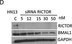 Western Blot: BMAL1 Antibody [NB100-2288] - Small interference RNA targeting Raptor & Rictor disrupts BMAL1 accumulation in HNSCCTargeted disruption of Raptor (A-B) & Rictor (C-D) using siRNA results in a dose-dependent downregulation of BMAL1 in HNSCC cells. E. Disruption of PTEN by protein oxidation causes activation of mTOR signaling, resulting in accumulation of BMAL1. Notably, inhibition of mTOR signaling, particularly mTORC1 & mTORC2, results in restoration of normal BMAL1 levels in the epidermis of mice & head & neck cancer cells. These results demonstrate a novel role for mTOR in regulating nuclear levels of the core clock gene BMAL1. Image collected & cropped by CiteAb from the following publication (//pubmed.ncbi.nlm.nih.gov/27285754), licensed under a CC-BY license. Not internally tested by Novus Biologicals.