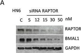 Western Blot: BMAL1 Antibody [NB100-2288] - Small interference RNA targeting Raptor & Rictor disrupts BMAL1 accumulation in HNSCCTargeted disruption of Raptor (A-B) & Rictor (C-D) using siRNA results in a dose-dependent downregulation of BMAL1 in HNSCC cells. E. Disruption of PTEN by protein oxidation causes activation of mTOR signaling, resulting in accumulation of BMAL1. Notably, inhibition of mTOR signaling, particularly mTORC1 & mTORC2, results in restoration of normal BMAL1 levels in the epidermis of mice & head & neck cancer cells. These results demonstrate a novel role for mTOR in regulating nuclear levels of the core clock gene BMAL1. Image collected & cropped by CiteAb from the following publication (//pubmed.ncbi.nlm.nih.gov/27285754), licensed under a CC-BY license. Not internally tested by Novus Biologicals.