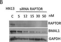 Western Blot: BMAL1 Antibody [NB100-2288] - Small interference RNA targeting Raptor & Rictor disrupts BMAL1 accumulation in HNSCCTargeted disruption of Raptor (A-B) & Rictor (C-D) using siRNA results in a dose-dependent downregulation of BMAL1 in HNSCC cells. E. Disruption of PTEN by protein oxidation causes activation of mTOR signaling, resulting in accumulation of BMAL1. Notably, inhibition of mTOR signaling, particularly mTORC1 & mTORC2, results in restoration of normal BMAL1 levels in the epidermis of mice & head & neck cancer cells. These results demonstrate a novel role for mTOR in regulating nuclear levels of the core clock gene BMAL1. Image collected & cropped by CiteAb from the following publication (//pubmed.ncbi.nlm.nih.gov/27285754), licensed under a CC-BY license. Not internally tested by Novus Biologicals.