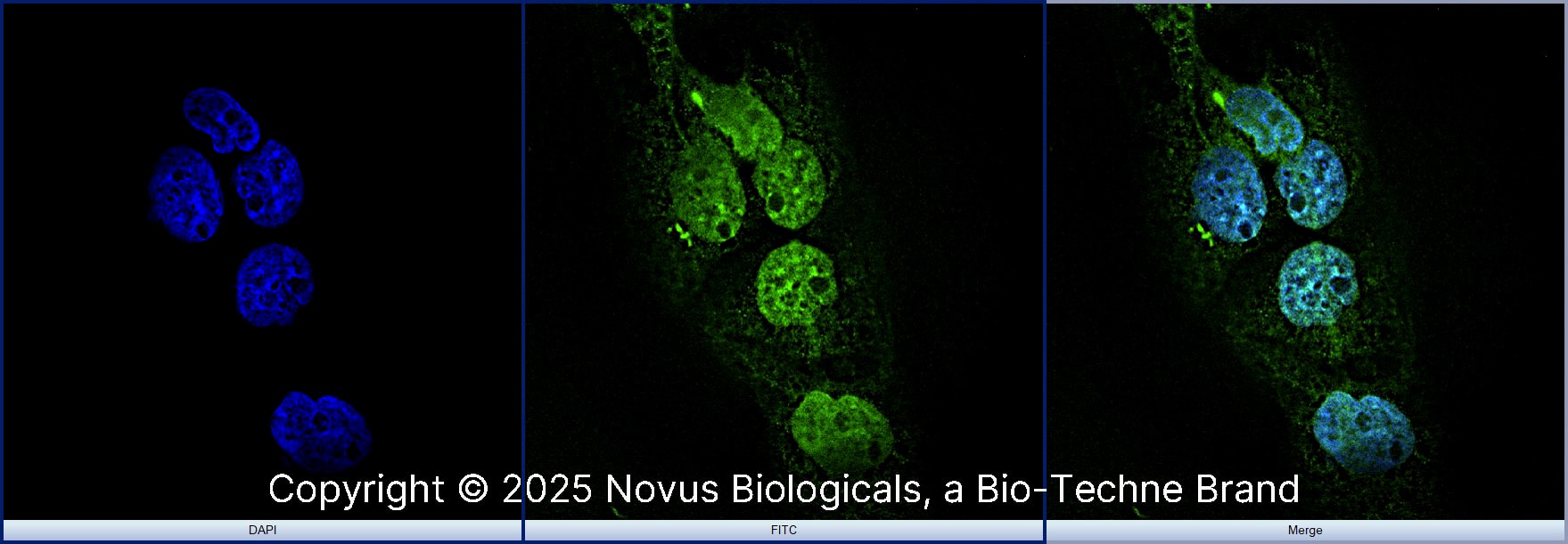 AHR was detected in immersion fixed A431 human skin carcinoma cell line using Rabbit anti-AHR Affinity Purified Polyclonal Antibody conjugated to FITC (Catalog # NB100-2289F) (green) at 10 µg/mL overnight at 4C. Cells were counterstained with DAPI (blue). Cells were imaged using a 100X objective and digitally deconvolved.