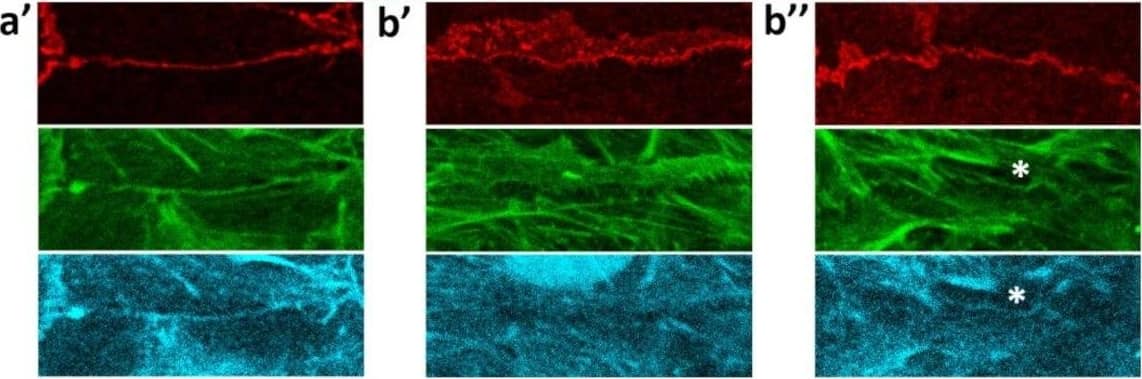 Immunocytochemistry/ Immunofluorescence: EPLIN Antibody [NB100-2305] - Effects of EGF on EPLIN in IAR-20 cells. (a), (a’) In control IAR-20 cells, EPLIN colocalizes with the circumferential actin bundles at cell-cell boundaries. (b) Addition of EGF leads to release of EPLIN from the zones of disorganization or disappearance of the circumferential bundles (Figure 8b’,b’’). EPLIN colocalizes with the remaining intact circumferential bundle (Figure 8b’’, asterisk). (c) EPLIN fluorescence intensity at the cell-cell boundaries in control & EGF-treated cells. Circles & squares represent individual cells, N = 35, * p < 0.001. (d) Western blot analysis of EPLIN phosphorylation (5% PAAG). Arrows indicate up-shifted bands of phosphorylated EPLIN in the cells treated with EGF.  beta -actin was used as loading control. Densitometry results are averaged across three independent experiments. Data are presented as mean ± SEM. (e) MEK inhibitor CI-1040 (4 µM), which inhibits phosphorylation of ERK (p-ERK), significantly decreases the levels of phosphorylated EPLIN at 10 min & 15 min after the addition of EGF.  alpha -tubulin was used as a loading control. Image collected & cropped by CiteAb from the following publication (//pubmed.ncbi.nlm.nih.gov/32121325), licensed under a CC-BY license. Not internally tested by Novus Biologicals.