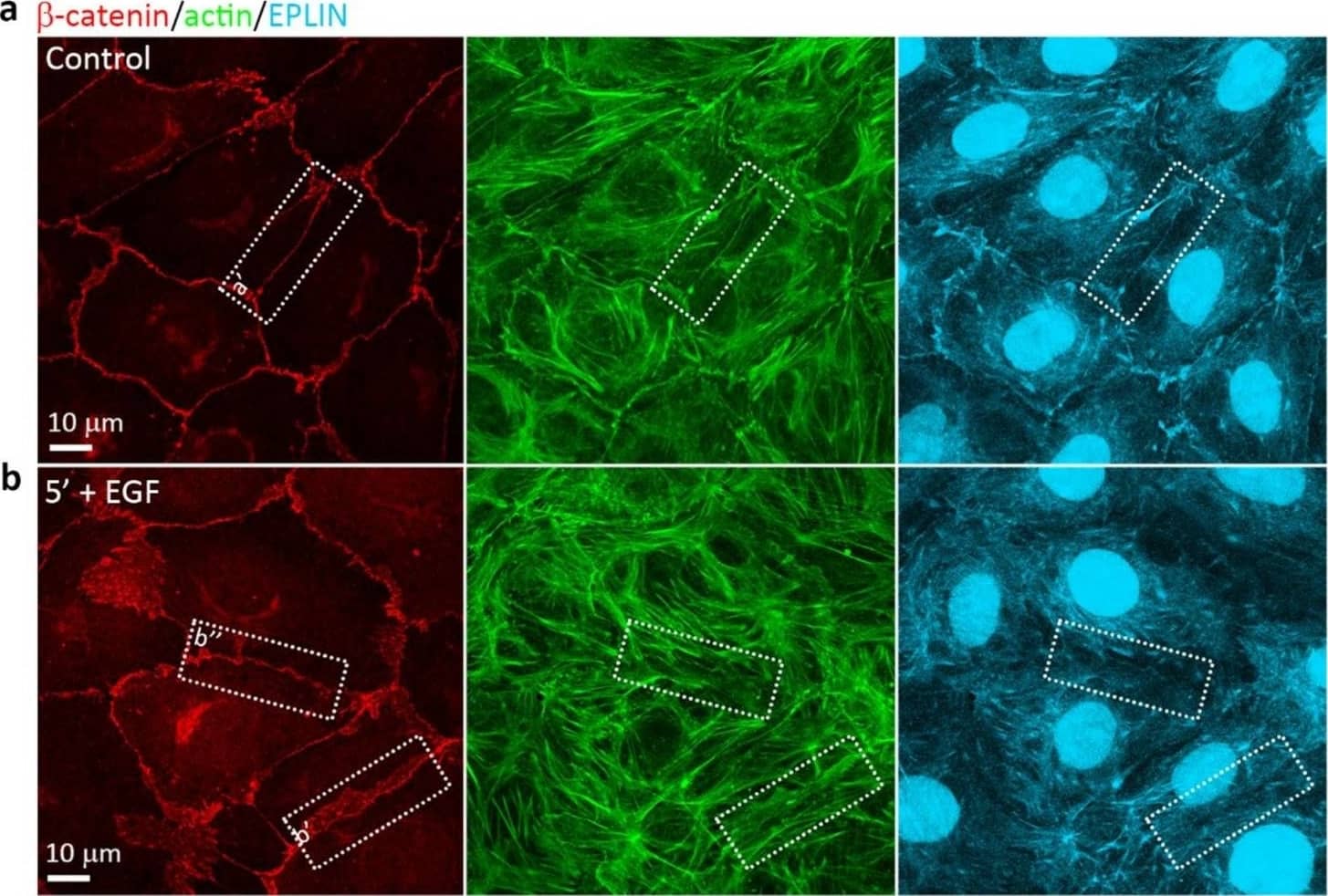 Immunocytochemistry/ Immunofluorescence: EPLIN Antibody [NB100-2305] - Effects of EGF on EPLIN in IAR-20 cells. (a), (a’) In control IAR-20 cells, EPLIN colocalizes with the circumferential actin bundles at cell-cell boundaries. (b) Addition of EGF leads to release of EPLIN from the zones of disorganization or disappearance of the circumferential bundles (Figure 8b’,b’’). EPLIN colocalizes with the remaining intact circumferential bundle (Figure 8b’’, asterisk). (c) EPLIN fluorescence intensity at the cell-cell boundaries in control & EGF-treated cells. Circles & squares represent individual cells, N = 35, * p < 0.001. (d) Western blot analysis of EPLIN phosphorylation (5% PAAG). Arrows indicate up-shifted bands of phosphorylated EPLIN in the cells treated with EGF.  beta -actin was used as loading control. Densitometry results are averaged across three independent experiments. Data are presented as mean ± SEM. (e) MEK inhibitor CI-1040 (4 µM), which inhibits phosphorylation of ERK (p-ERK), significantly decreases the levels of phosphorylated EPLIN at 10 min & 15 min after the addition of EGF.  alpha -tubulin was used as a loading control. Image collected & cropped by CiteAb from the following publication (//pubmed.ncbi.nlm.nih.gov/32121325), licensed under a CC-BY license. Not internally tested by Novus Biologicals.