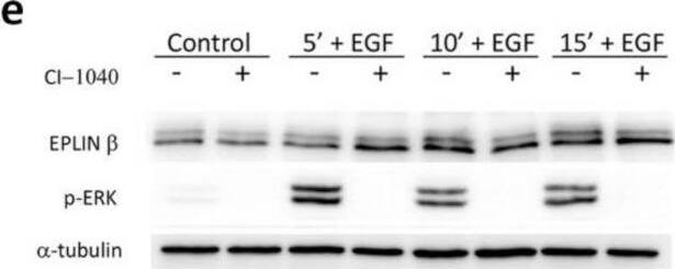 Effects of EGF on EPLIN in IAR-20 cells. (a), (a’) In control IAR-20 cells, EPLIN colocalizes with the circumferential actin bundles at cell-cell boundaries. (b) Addition of EGF leads to release of EPLIN from the zones of disorganization or disappearance of the circumferential bundles (Figure 8b’,b’’). EPLIN colocalizes with the remaining intact circumferential bundle (Figure 8b’’, asterisk). (c) EPLIN fluorescence intensity at the cell-cell boundaries in control and EGF-treated cells. Circles and squares represent individual cells, N = 35, * p < 0.001. (d) Western blot analysis of EPLIN phosphorylation (5% PAAG). Arrows indicate up-shifted bands of phosphorylated EPLIN in the cells treated with EGF.  beta -actin was used as loading control. Densitometry results are averaged across three independent experiments. Data are presented as mean +/- SEM. (e) MEK inhibitor CI-1040 (4 uM), which inhibits phosphorylation of ERK (p-ERK), significantly decreases the levels of phosphorylated EPLIN at 10 min and 15 min after the addition of EGF.  alpha -tubulin was used as a loading control. Image collected and cropped by CiteAb from the following open publication (//pubmed.ncbi.nlm.nih.gov/32121325), licensed under a CC-BY license. Not internally tested by Novus Biologicals.