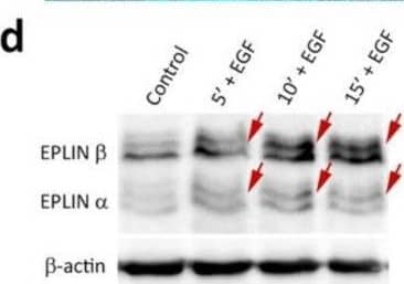 Effects of EGF on EPLIN in IAR-20 cells. (a), (a’) In control IAR-20 cells, EPLIN colocalizes with the circumferential actin bundles at cell-cell boundaries. (b) Addition of EGF leads to release of EPLIN from the zones of disorganization or disappearance of the circumferential bundles (Figure 8b’,b’’). EPLIN colocalizes with the remaining intact circumferential bundle (Figure 8b’’, asterisk). (c) EPLIN fluorescence intensity at the cell-cell boundaries in control and EGF-treated cells. Circles and squares represent individual cells, N = 35, * p < 0.001. (d) Western blot analysis of EPLIN phosphorylation (5% PAAG). Arrows indicate up-shifted bands of phosphorylated EPLIN in the cells treated with EGF.  beta -actin was used as loading control. Densitometry results are averaged across three independent experiments. Data are presented as mean +/- SEM. (e) MEK inhibitor CI-1040 (4 uM), which inhibits phosphorylation of ERK (p-ERK), significantly decreases the levels of phosphorylated EPLIN at 10 min and 15 min after the addition of EGF.  alpha -tubulin was used as a loading control. Image collected and cropped by CiteAb from the following open publication (//pubmed.ncbi.nlm.nih.gov/32121325), licensed under a CC-BY license. Not internally tested by Novus Biologicals.