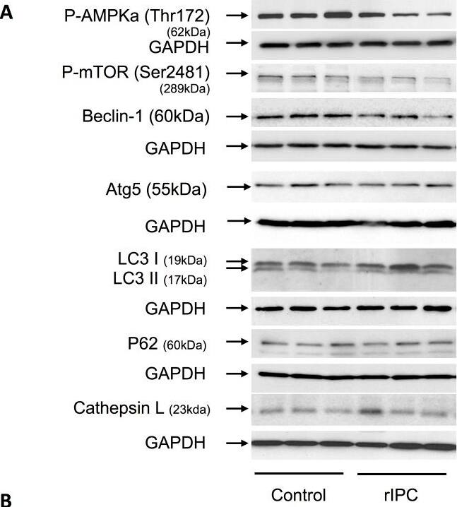 Western Blot: LC3A Antibody - BSA Free [NB100-2331] - Delayed, second window RIC maintains mTOR inhibition without activating autophagosome machinery.(A) Western blots for autophagy related signaling proteins. (B) Quantification of the protein fold change in 2W RIC compared to 2W controls. Values are means ± S.E.M. n = 6–8 per group. An (*) denotes a statistically significant difference (P<0.05) compared to control. (P-: phospho-). Image collected & cropped by CiteAb from the following publication (//pubmed.ncbi.nlm.nih.gov/25347774), licensed under a CC-BY license. Not internally tested by Novus Biologicals.