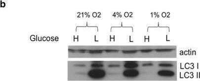 Western Blot: LC3A Antibody - BSA Free [NB100-2331] - Autophagy responds rapidly to changing glucose conditions. Immortalized MSCs were cultured in physiologic (also called low in culture parlance; 1 g/L; 5.5 mM) or high (4.5 g/L; 25 mM) glucose media for 2 days & then changed to the corresponding opposite glucose concentration for up to 96 h. Myosin light chain 3 (LC3) levels were probed via immunoblot to assess autophagic response (a). The role of oxygen in the glucose response was also assessed by culturing the MSCs in a Biospherix hypoxic chamber at 4% & 1% oxygen in high & low glucose media for 4 days, followed by comparable LC3 blots (b). Shown are representative blots of three repeated studies.  alpha -Actinin was used as a housekeeping control for all blots Image collected & cropped by CiteAb from the following publication (//stemcellres.biomedcentral.com/articles/10.1186/s13287-016-0436-7), licensed under a CC-BY license. Not internally tested by Novus Biologicals.