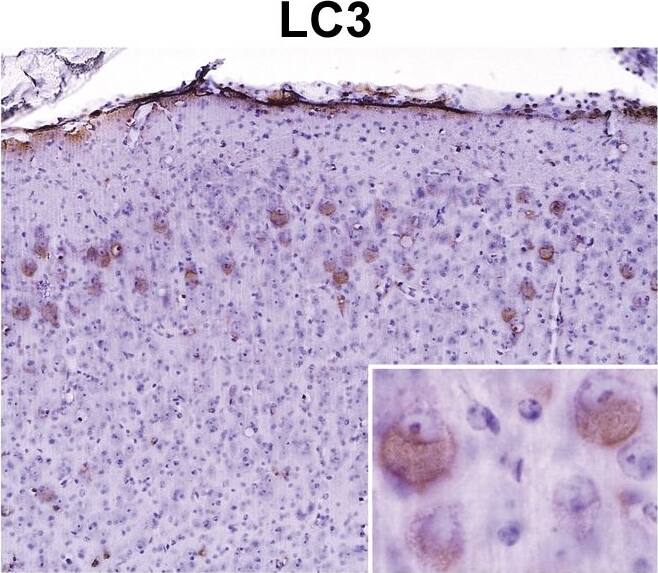 Immunohistochemistry: LC3A Antibody - BSA Free [NB100-2331] - Elevated levels of various proteins in MEC & in dentate gyrus of MPS IIIA brain.Staining was performed with antibodies against the proteins shown in a 7 months-old MPS IIIA mouse brain. The first 3 rows are for the MEC region & the bottom row for dentate gyrus. Age-matched C57BL6 mice, used as controls, showed no staining in the MEC region (not shown). The dentate gyrus showed AT270 inclusions in MPS IIIA (−/−) mouse brain (arrows) but not in the C57BL/6 (control) brain (bottom row). Image collected & cropped by CiteAb from the following publication (//dx.plos.org/10.1371/journal.pone.0027461), licensed under a CC-BY license. Not internally tested by Novus Biologicals.