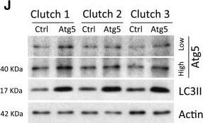 Western Blot: LC3A Antibody - BSA Free [NB100-2331] - Modulation of A152T-tau clearance & pathology by upregulation of autophagy. (J–N) Injection of an expression vector encoding zebrafish atg5 into A152T-tau fish embryos resulted in over-expression of Atg5 protein at 2 dpf (J & K) (high & low exposure of same blot presented; mean ± SD, n = 6 independent clutches; two-tailed t-test, *P < 0.05 versus control). (J & L) The increase in Atg5 protein correlated with increase in LC3II, a well-characterized reporter for autophagosome number, demonstrating that autophagy was upregulated in Atg5-injected fish (mean ± SEM, n = 8 independent clutches; two-tailed t-test, ***P < 0.001 versus control). Image collected & cropped by CiteAb from the following publication (//academic.oup.com/brain/article/140/4/1128/2980948), licensed under a CC-BY license. Not internally tested by Novus Biologicals.