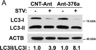 Western Blot: LC3A Antibody - BSA Free [NB100-2331] - Endogenous MIR376A limits starvation-induced autophagy.(A) Blockage of endogenous MIR376A by Ant-376a, but not CNT-Ant further stimulated starvation (STV)-activated LC3-I to LC3-II conversion in MCF-7 cells. ACTB was used as a loading control. LC3-II/LC3-I densitometric ratios were marked. (B) Ant-376a, but not CNT-Ant resulted in further activation of SQSTM1 protein degradation following starvation in MCF-7 cells. SQSTM1/ACTB ratios were marked. Image collected & cropped by CiteAb from the following publication (//pubmed.ncbi.nlm.nih.gov/24358205), licensed under a CC-BY license. Not internally tested by Novus Biologicals.