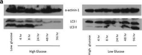 Western Blot: LC3A Antibody - BSA Free [NB100-2331] - Autophagy responds rapidly to changing glucose conditions. Immortalized MSCs were cultured in physiologic (also called low in culture parlance; 1 g/L; 5.5 mM) or high (4.5 g/L; 25 mM) glucose media for 2 days & then changed to the corresponding opposite glucose concentration for up to 96 h. Myosin light chain 3 (LC3) levels were probed via immunoblot to assess autophagic response (a). The role of oxygen in the glucose response was also assessed by culturing the MSCs in a Biospherix hypoxic chamber at 4% & 1% oxygen in high & low glucose media for 4 days, followed by comparable LC3 blots (b). Shown are representative blots of three repeated studies.  alpha -Actinin was used as a housekeeping control for all blots Image collected & cropped by CiteAb from the following publication (//stemcellres.biomedcentral.com/articles/10.1186/s13287-016-0436-7), licensed under a CC-BY license. Not internally tested by Novus Biologicals.