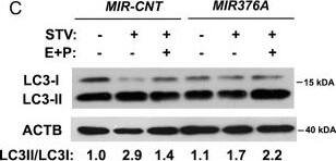 Western Blot: LC3A Antibody - BSA Free [NB100-2331] - MIR376A overexpression blocked autophagy in Huh-7 cells.(A) MIR376A blocked GFP-LC3 dot formation under starvation condition. (B) Quantitative analysis of experiments in A (mean ± S.D. of independent experiments, n = 3, ***p<0,01). (C) Overexpression of MIR376A resulted in decreased autophagic flux in Huh-7 cells. Starvation-induced conversion of LC3-I to LC3-II was analyzed. Tests were performed in the presence or absence of E64d (10 µg/ml) & Pepstatin A (10 µg/ml) (E+P). LC3-II/LC3-I densitometric ratios were marked. ACTB was used as a loading control. Image collected & cropped by CiteAb from the following publication (//pubmed.ncbi.nlm.nih.gov/24358205), licensed under a CC-BY license. Not internally tested by Novus Biologicals.