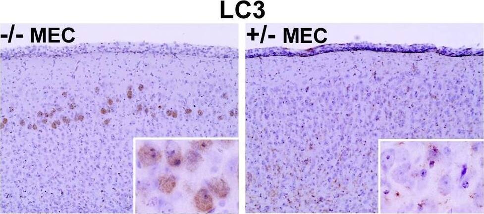 Immunohistochemistry: LC3A Antibody - BSA Free [NB100-2331] - Elevated levels of additional proteins & GM3 ganglioside in the MEC of MPS IIIB brain.Staining performed with antibodies to the indicated substances was observed in the MEC region of 3 month-old MPS IIIB mice (for total ubiquitin & polyubiquitin) & 6 months for all others. Staining was not seen in the MEC region of age-matched control mice (Naglu +/−) nor in the LEC region of MPS IIIB mice (the latter not shown). Image collected & cropped by CiteAb from the following publication (//dx.plos.org/10.1371/journal.pone.0027461), licensed under a CC-BY license. Not internally tested by Novus Biologicals.