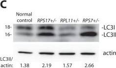 Western Blot: LC3A Antibody - BSA Free [NB100-2331] - DBA mutations induce autophagy.(A) Immunofluorescence with LC3 antibodies in LCLs derived from a normal control or DBA patients. Higher magnifications are represented in the lower panel. Arrows denote puncta indicative of LC3 recruitment to autophagosomes, or accumulation in autolysosomes. Size bars = 10 µM. (B) Quantification of the percent of cells revealing LC3 puncta compared to the total number of cells in the 60x shots. (C) Western blot analysis of LC3 in DBA LCLs compared to normal controls. The LC3II/actin ratio is determined by densitometer analysis. (D) Representative western blot analysis of p62 levels in normal control & DBA patient LCLs. (E) Densitometer analysis of p62 protein expression from western blots (N = 3) represented in (D). (F) Immunofluorescence with p62 antibodies of LCLs derived from a normal control or DBA patients. Size bars = 10 µM. (G) ImageJ measurements of p62 expression in (F) per total cell area. (H) Representative electron micrographs of LCLs derived from a normal control & RPS17 cells. Control cells have small typically dense lysosomes (*). The much larger autolysosomes (A) are only detected in RPS17 LCLs. The boxed area in the upper right panel is shown at higher magnification in the lower right panel. N = nucleus, ECS = extracellular space. Bars in top panels = 1 µM, bottom panels = 200 nM. Image collected & cropped by CiteAb from the following publication (//dx.plos.org/10.1371/journal.pgen.1004371), licensed under a CC-BY license. Not internally tested by Novus Biologicals.