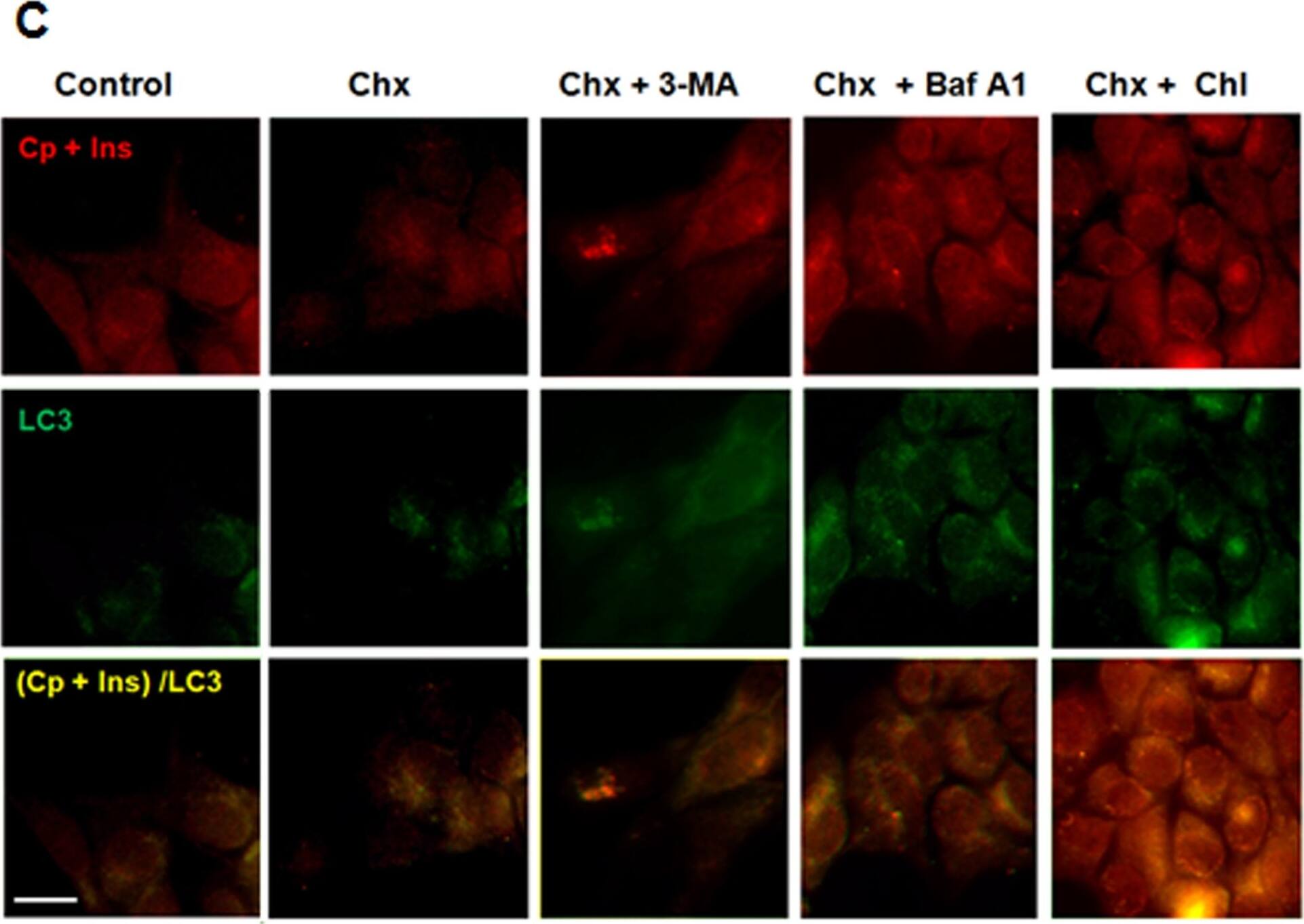 Immunocytochemistry/ Immunofluorescence: LC3A Antibody - BSA Free [NB100-2331] - Macroautophagy is a major mechanism in the rapid disposal of insulin precursor in  beta -cells.The Ins2+/+  beta -cells were cultured under the 5.5 mM glucose concentration for a 24-hour pre-experimental period until treatment. (A) The Ins2+/+  beta -cells were treated with cycloheximide (Chx; 100 µg/mL), Chx (100 µg/mL) & 3-MA (5 mM), Baf A1 (5 µM), or chloroquine (Chl; 100 µg/mL) for 30 minutes with an untreated control. Cellular proteins (30 µg) were separated by 16.5% non-reduced (upper panels) or reduced (lower panels) tricine SDS-PAGE & then examined by immunoblotting. (B) The upper panel, the immunoreactive LC3-I/II (%) in individual treatments in (A); the lower panel, the percentages of proinsulin levels on reduced gels (that were normalized by tubulin) in individual treatments compared to the untreated controls. (C) The Ins2+/+  beta -cells subjected to the same treatments described in (A) were immunostained with antibodies against LC3, C-peptide, & insulin as described in the Materials & Methods. Fluorescent Cy2 (for LC3), Cy3 (for C-peptide & insulin), & their merged images were shown. The scale of bar in (C), 10 µm. (D) The relative levels (%) of the LC3 & (pro)insulin and/or C-peptide positive dots per cell of individual treatments in (C). The data in (B) or (D) were reported as mean ± SD. *P<0.05; **P<0.01, n = 4. Image collected & cropped by CiteAb from the following publication (//dx.plos.org/10.1371/journal.pone.0027647), licensed under a CC-BY license. Not internally tested by Novus Biologicals.