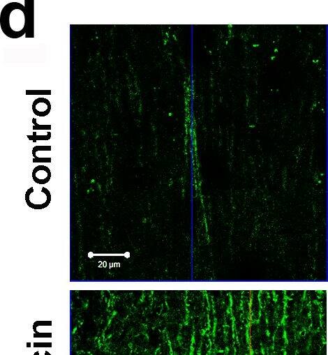 Immunohistochemistry: LC3A Antibody - BSA Free [NB100-2331] - Rapamycin increases autophagy in brains of PDAPP mice.a, f & h, representative immunoblots of hippocampal lysates from control- & rapamycin-treated transgenic PDAPP mice & non-transgenic littermate controls. b, g & i, quantitative analyses. a & b, LC3-II levels are decreased in hippocampi of rapamycin-treated transgenic PDAPP mice (*, P = 0.0009), but not in hippocampi of rapamycin-treated non-transgenic littermates. c & d, representative epifluorescent (c, 200×) & higher-magnification confocal (d, 600×) images of hippocampal CA1 (e, green box, region of epifluorescent images; blue box, region of confocal images) in control- & rapamycin-fed transgenic PDAPP mice stained with an anti-LC3 antibody. An increase in LC3-immunoreactive puncta was observed in CA1 projections of transgenic PDAPP mice following rapamycin administration. f & g, levels of the autophagic substrate p62SQSTM are decreased (*, P = 0.0015) in hippocampi of rapamycin-treated PDAPP transgenic mice. f, representative Western blots; g, quantitative analyses of p62SQSTM levels. h & i, Levels of phosphorylated (activated) p70 were decreased in brains of rapamycin-treated PDAPP & non-transgenic mice (*, P = 0.001 & P = 0.04 respectively). Significance of differences between group means were determined using two-tailed unpaired Student's t test. Data are means ± SEM. Image collected & cropped by CiteAb from the following publication (//dx.plos.org/10.1371/journal.pone.0009979), licensed under a CC-BY license. Not internally tested by Novus Biologicals.