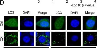 <b>Biological Strategies Validation. </b> OXI initiates autophagy and inhibits fusion of autophagosome and lysosome in CRC cells. (A) Normalized intensity values of upregulated and downregulated proteins in HCT116 cells treated with OXI (30 μM) were shown in heat map. (B) KEGG pathway and GO analyses of changed proteins in A. (C) Western blotting analysis of LC3 turnover, ATG5 and Beclin1 protein levels in OXI-treated CRC cells. (D) LC3 puncta in RKO and HCT116 cells were detected by immunofluorescent analysis after treatment of DMSO or OXI (30 μM). (E) Quantification of LC3 puncta. Scale bars, 10 μm. (F) Western blotting analysis of LC3 turnover in HCT116 and RKO cells transfected with siATG5 or siScramble and treated with OXI (30 μM). (G) Western blotting analysis of LC3 turnover, p62 and ubiquitinated proteins in HCT116 and RKO cells treated with OXI (30 μM) in combination with CQ (10 μM) for 24 h. (H) IF analysis of HCT116 and RKO cells transfected with the tandem mRFP-GFP-tagged LC3B plasmids and treated with OXI (30 μM). Scale bars, 10 μm. (I) Quantification of the ratio of yellow puncta (autophagosome) versus red puncta (autolysosome). (J) The expression of LC3 in xenografts was evaluated by IHC. Scale bar: 50 μm. All data are means +/- SD. Image collected and cropped by CiteAb from the following open publication (//pubmed.ncbi.nlm.nih.gov/35813474), licensed under a CC-BY license. Not internally tested by Novus Biologicals.