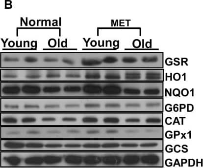 Western Blot: Glucose 6 Phosphate Dehydrogenase Antibody [NB100-236] - Effect of prolonged moderate exercise on Nrf2/ARE-Antioxidants in the aging heart.Representative immunoblots of cytosolic extracts from the hearts of young & old mice under basal conditions & following 6-weeks of moderate exercise training (MET). Protein blots were probed with respective antibodies as indicated. Individual lanes represent separate animals (n = 4–6/group). A. Analysis of nuclear Nrf2 in young & old mice subjected to MET. In sedentary mice, Nrf2 protein levels were decreased significantly in old when compared to young (*p<0.05). Following MET, nuclear Nrf2 levels were significantly increased in old mice to levels equivalent to those of young mice (#, $p<0.05 in MET vs. respective basal). (B) Densitometry analysis of respective protein signals were performed using Image-J & expressed relative to mean values of the sedentary-young group. Under basal conditions, a significant decrease in the protein levels of GSR, G6PD, NQO1, catalase, GPX1 & GCS were observed in the heart tissues of old when compared to young mice. Following 6-weeks of moderate exercise, most of the antioxidants were significantly (*p<0.05) upregulated or stabilized in the aging heart. Image collected & cropped by CiteAb from the following publication (//dx.plos.org/10.1371/journal.pone.0045697), licensed under a CC-BY license. Not internally tested by Novus Biologicals.