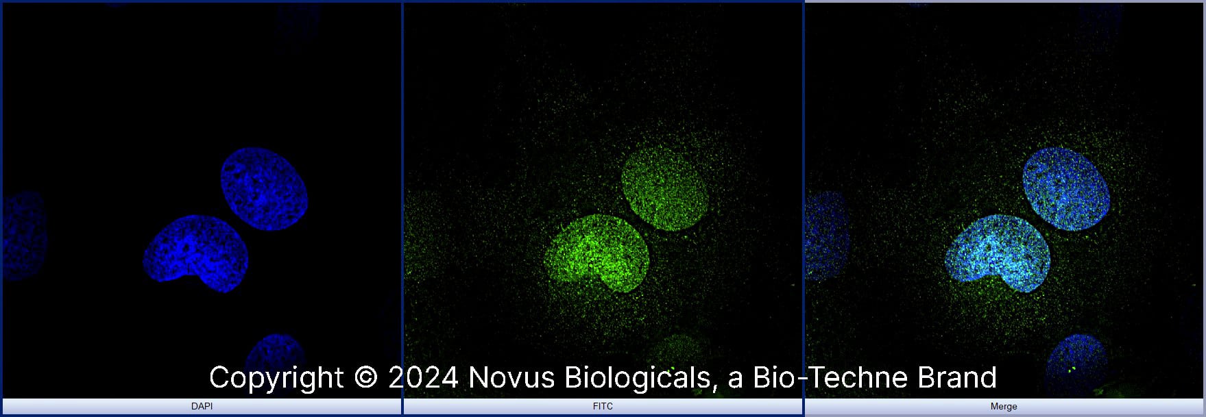 OCT4 was detected in immersion fixed U-2 OS human osteosarcoma cell line using Rabbit anti-OCT4 Affinity Purified Polyclonal Antibody conjugated to Alexa Fluor® 488 (Catalog # NB100-2379AF488) (green) at 10 µg/mL overnight at 4C. Cells were counterstained with DAPI (blue). Cells were imaged using a 100X objective and digitally deconvolved. 