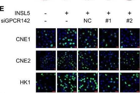 INSL5 promotes the progression of NPC via accelerating cell proliferation and invasion depending on GPCR142AExogenous expression of INSL5 in NPC cells. Representative immunoblotting (upper panel) and immunofluorescent staining (lower panel) showed stable exogenous expression of INSL5 in both CNE1, CNE2, and HK1 NPC cell lines. Scale bars represent 20 μm.BMTT assay of vector control or INSL5 overexpressing CNE1, CNE2, and HK1 NPC cell lines (upper panel) either transfected with control siRNA (NC) or GPCR142 siRNA (#1 and #2) (lower panel). n = 4 biological replicates for CNE1 and CNE2 cell line, n = 6 biological replicates for HK1.C–HColony formation (C and D), Brdu incorporation (E and F), and migration assays (G and H) of vector control or INSL5 overexpressing CNE1, CNE2, and HK1 NPC cell lines either transfected with control siRNA (NC) or GPCR142 siRNA (#1 and #2). Representative images are shown in (C), (E), and (G) for colony formation, Brdu incorporation, and migration assays, respectively. Number of colonies, the percentage of Brdu positive cells, and migrated cells per field of view were plotted in (D, F, and H), respectively. The results are from three different experiments. Scale bars represent 20 μm in (E) and 100 μm in (G)I, JXenograft tumor growth of INSL5 overexpression NPC HK1 stable cell lines in nude mice. Tumor size (I) and tumor weight (J) of two groups. n = 11 mice per group.Data information: In (B, I, and J), data are presented as mean +/- SD, in (D, F, and H), data are presented as mean +/- SEM, from three different experiments, and P‐values were determined by unpaired t‐test. *P < 0.05, **P < 0.01, ***P < 0.001, ns, no significance. Exact P‐values are specified in Appendix Table S4.Source data are available online for this figure. Image collected and cropped by CiteAb from the following open publication (//pubmed.ncbi.nlm.nih.gov/32657028), licensed under a CC-BY license. Not internally tested by Novus Biologicals.