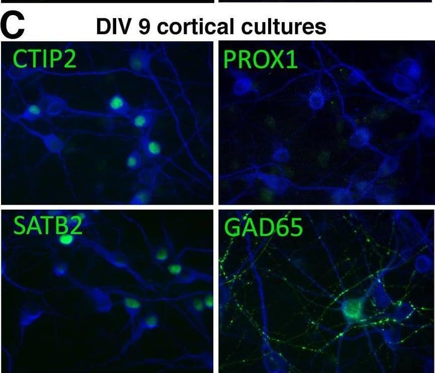 Time course of expression of Ctip2, Satb2, GAD65 in cultures derived from E18 rat hippocampus or cortex.(A) DIV9 hippocampal neurons were stained with MAP2 and counterstained against Ctip2, Prox1, Satb2, and GAD65. (B) E18 hippocampal cultures were stained at DIV1, 3, 9, 18 as in (A) and the proportion among MAP2-positive neurons was quantified in three separate experiments. Means and standard deviations are shown. Black bars = Ctip2-positive; brick bars = Satb2-positive; white bars = Prox1-positive; striped bars = GAD65-positive. In each experiment, 300 to >1000 MAP2-positive neurons were counted. (C) DIV9 cortical neurons were stained with MAP2 and counterstained against Ctip2, Prox1, Satb2, and GAD65. (D) E18 cortical cultures were stained at DIV1, 3, 9, 18 as in (C) and the proportion among MAP2-positive neurons was quantified in three separate experiments. Means and standard deviations are shown. Black bars = Ctip2-positive; brick bars = Satb2-positive; white bars = Prox1-positive; striped bars = GAD65-positive. In each experiment, 300 to >1000 MAP2-positive neurons were counted. Image collected and cropped by CiteAb from the following open publication (//pubmed.ncbi.nlm.nih.gov/26465886), licensed under a CC-BY license. Not internally tested by Novus Biologicals.