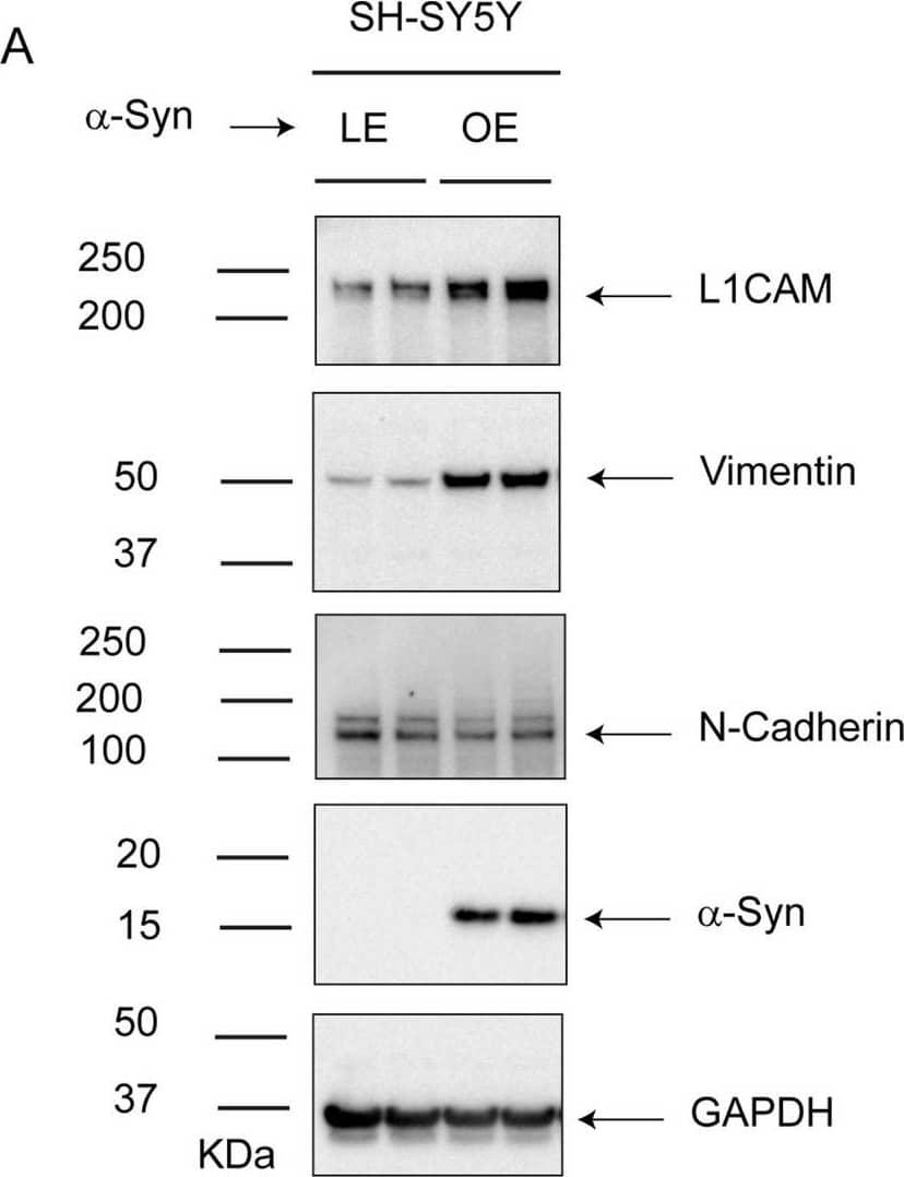 Expressing  alpha -syn in SH-SY5Y cells increases L1CAM and motility. (A) Representative western blots of L1CAM, vimentin, N-Cad,  alpha -syn, and  alpha -tubulin in lysates of control and SH/ alpha S cells cultured in vitro. Quantitative analyses representing the relative protein levels were measured by normalizing the band intensities of L1CAM and N-Cad (B) and vimentin (C) to  alpha -tubulin. All the experiments were repeated with at least with three biological replicates (n = 3–6). (D) Representative brightfield microscope images of phagokinetic tracks created by control and  alpha -syn overexpressing SH-SY5Y cells on colloidal gold-coated wells. The images were acquired using a light microscope with a ×10  objective. The individual phagokinetic tracks represented by black arrow marks were measured using ImageJ software and represented in (E). At least 33 tracks per experimental condition were randomly chosen for quantification. A total of 100 tracks for n = 3 per experimental group were used for statistical analysis. Values in plots (B,C,E) are mean +/- s.d. P-values were determined by a two-sided Student’s t test. Image collected and cropped by CiteAb from the following open publication (//pubmed.ncbi.nlm.nih.gov/37286800), licensed under a CC-BY license. Not internally tested by Novus Biologicals.