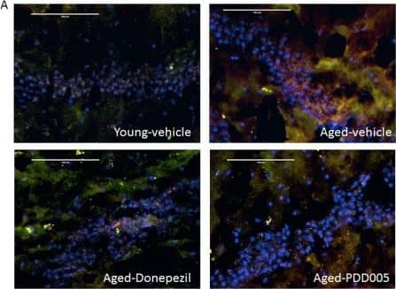 Immunocytochemistry/ Immunofluorescence: AIF-1/Iba1 Antibody [NB100-2833] - IL-1  beta  synthesis, & microglial activation modulation in PDD005-treated aged mice. (A) Images showing IL-1 beta  (green fluorescence), iba-1 (red fluorescence) expression. Yellow = Overlay; Blue = nuclei; SGZ region of mouse brain. 40X magnification, scale bar = 100 μm. (B) Graphs representing the average relative fluorescence of Iba-1 in SGZ. Significant differences determined by using one-way ANOVA with Tukey’s test. *P < 0.050, **P < 0.01 & ***P < 0.001 compared with aged-vehicle. Image collected & cropped by CiteAb from the following publication (//pubmed.ncbi.nlm.nih.gov/31980673), licensed under a CC-BY license. Not internally tested by Novus Biologicals.