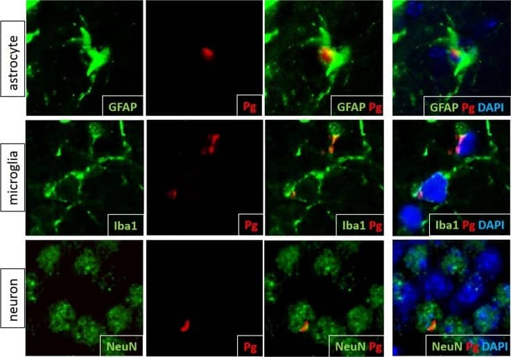 Immunocytochemistry/ Immunofluorescence: AIF-1/Iba1 Antibody [NB100-2833] - Pg/gingipain is present intracellularly in astrocytes, microglia & neurons in the hippocampus of experimental mice.Green: astrocytes (top panels), microglia (middle panels), & neurons (bottom panels). Red: Pg/gingipain. Blue: DAPI. Representative of N = 4 (GFAP), 3 (Iba1) & 4 (NeuN) experimental mice. Image collected & cropped by CiteAb from the following publication (//pubmed.ncbi.nlm.nih.gov/30281647), licensed under a CC-BY license. Not internally tested by Novus Biologicals.