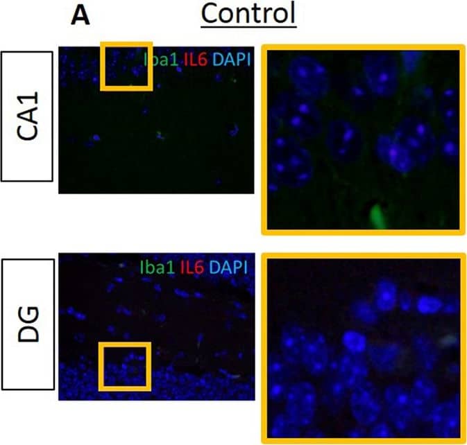 Immunocytochemistry/ Immunofluorescence: AIF-1/Iba1 Antibody [NB100-2833] - Proinflammatory cytokines IL6, IL1 beta  & TNF alpha  are evident in the hippocampus of experimental but not in control mice.Data from IF microscopy & RT-PCR. (A-F) Results from IF microscopy. IL6 expression in control (A) & experimental (B) mice, IL1 beta  expression in control (C) & experimental (D) mice & TNF alpha  expression in control (E) & experimental (F) mice. N = 3 mice/group. (G-I) Gene expression of cytokines was detected by RT-PCR (G, H, I). In all cases, there is significantly higher gene expression of all three cytokines in experimental compared with control group (G, H, I). Green: Iba1, Red: cytokines, Blue: DAPI. N = 5 mice/group. Image collected & cropped by CiteAb from the following publication (//pubmed.ncbi.nlm.nih.gov/30281647), licensed under a CC-BY license. Not internally tested by Novus Biologicals.