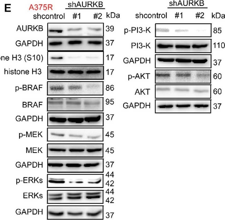  AURKB mediates EGF associated BRAF/MEK/ERKs and PI3-K/AKT pathways. (A, B) Knocking down of AURKB suppressed the level of EGF in A375 and A375R tumor from xenograft mice compared with shcontrol. The asterisks indicate a significant difference compared with the shcontrol group (*, p < 0.05; ** p < 0.01). (C) Knocking down of AURKB increased levels of c-PARP, c-caspase 3, and decreased of Bcl-2 level of A375 and A375R cell lines. (D, E) Western blot analysis of activation of BRAF/MEK/ERKs and PI3-K/AKT by knocking down of AURKB in A375 and A375R cell lines. Image collected and cropped by CiteAb from the following open publication (//pubmed.ncbi.nlm.nih.gov/32863956), licensed under a CC-BY license. Not internally tested by Novus Biologicals.
