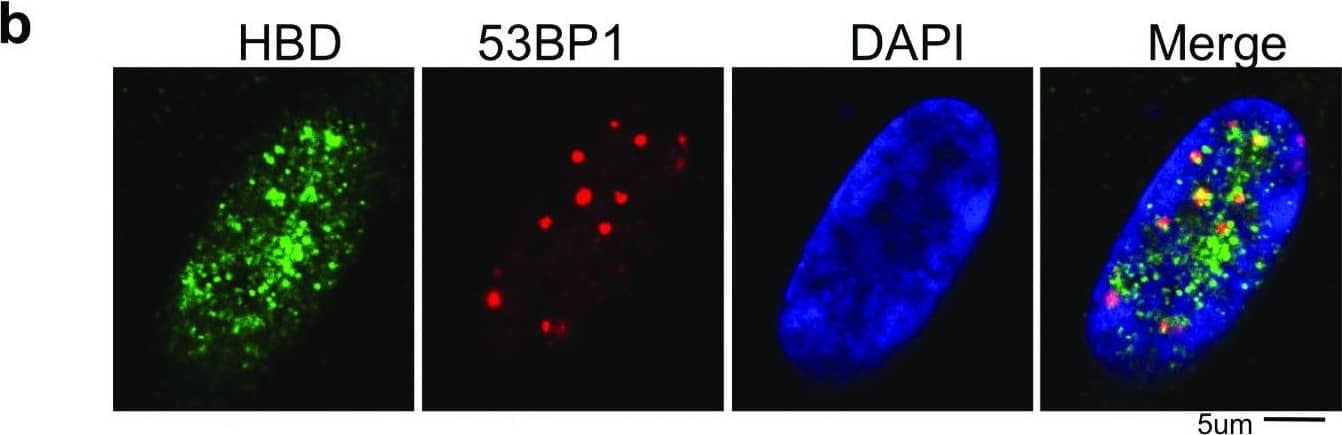 Immunocytochemistry/ Immunofluorescence: 53BP1 Antibody - BSA Free [NB100-304] - RNA:DNA hybrids promote 53BP1 foci formation.(a) Immunofluorescence using the anti-flag & anti-53BP1 antibody in cells expressing Flag-tagged hybrid-binding (HB) domain or flag-tagged active RNaseH1. 53BP1 foci were quantified in cells expressing HB-domain or RNaseH1. Column bars represent the mean of n number of cells (described on each column), from three independent experiments. Error bars represent SEM. *P ≤ 0.05; **P < 0.01, ***P < 0.001 using the Kruskal-Wallis test followed by Dunn’s post hoc test. (b) Higher zoom representative images show HB-domain & 53BP1 co-localization, specifically in the euchromatin area. Image collected & cropped by CiteAb from the following publication (//pubmed.ncbi.nlm.nih.gov/30345028), licensed under a CC-BY license. Not internally tested by Novus Biologicals.
