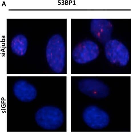 Immunocytochemistry/ Immunofluorescence: 53BP1 Antibody - BSA Free [NB100-304] - Depletion of Ajuba results in activation of the DNA damage response. (A) Staining for p53BP1 foci on cells fixed 72 h after transfection with siRNA #3, & siGFP as a negative control. Quantification of the number of p53BP1 foci on three independent siRNA experiments shown in (B). (C, D) Western blots for induction of Chk1 phosphorylation & induction of p53 phosphorylation, showed for the three target sites, 72 h after siRNA transfection. Image collected & cropped by CiteAb from the following publication (//pubmed.ncbi.nlm.nih.gov/23755068), licensed under a CC-BY license. Not internally tested by Novus Biologicals.