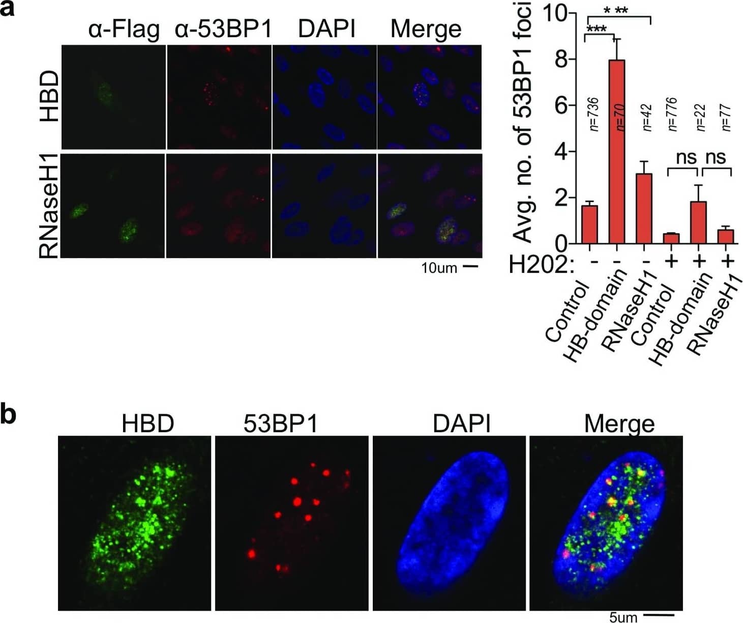Immunocytochemistry/ Immunofluorescence: 53BP1 Antibody - BSA Free [NB100-304] - RNA:DNA hybrids promote 53BP1 foci formation.(a) Immunofluorescence using the anti-flag & anti-53BP1 antibody in cells expressing Flag-tagged hybrid-binding (HB) domain or flag-tagged active RNaseH1. 53BP1 foci were quantified in cells expressing HB-domain or RNaseH1. Column bars represent the mean of n number of cells (described on each column), from three independent experiments. Error bars represent SEM. *P ≤ 0.05; **P < 0.01, ***P < 0.001 using the Kruskal-Wallis test followed by Dunn’s post hoc test. (b) Higher zoom representative images show HB-domain & 53BP1 co-localization, specifically in the euchromatin area. Image collected & cropped by CiteAb from the following publication (//pubmed.ncbi.nlm.nih.gov/30345028), licensed under a CC-BY license. Not internally tested by Novus Biologicals.